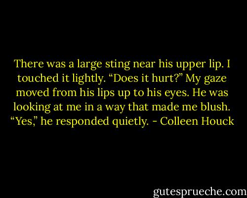 There was a large sting near his upper lip. I touched it lightly. “Does it hurt?”<br />My gaze moved from his lips up to his eyes. He was looking at me in a way that made me blush.<br />“Yes,” he responded quietly. - Colleen Houck